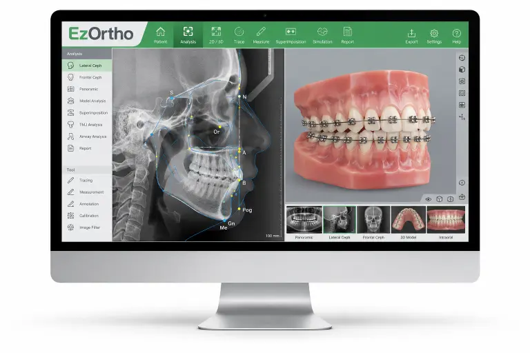 EzOrtho - website.product | MH Tech